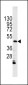 ILK1/ILK2 Antibody (N-term)